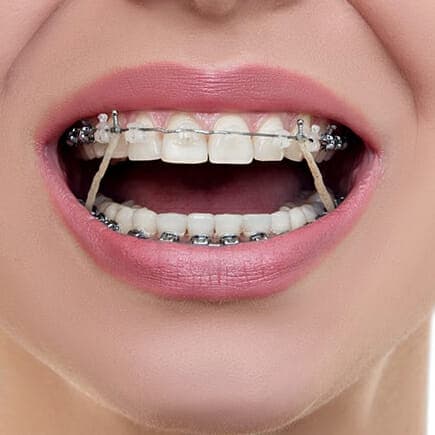 elastics-new
