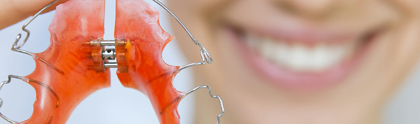 Retainers