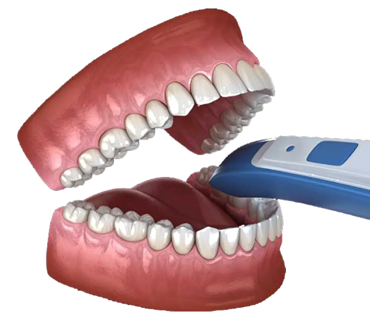 iTero® Element™